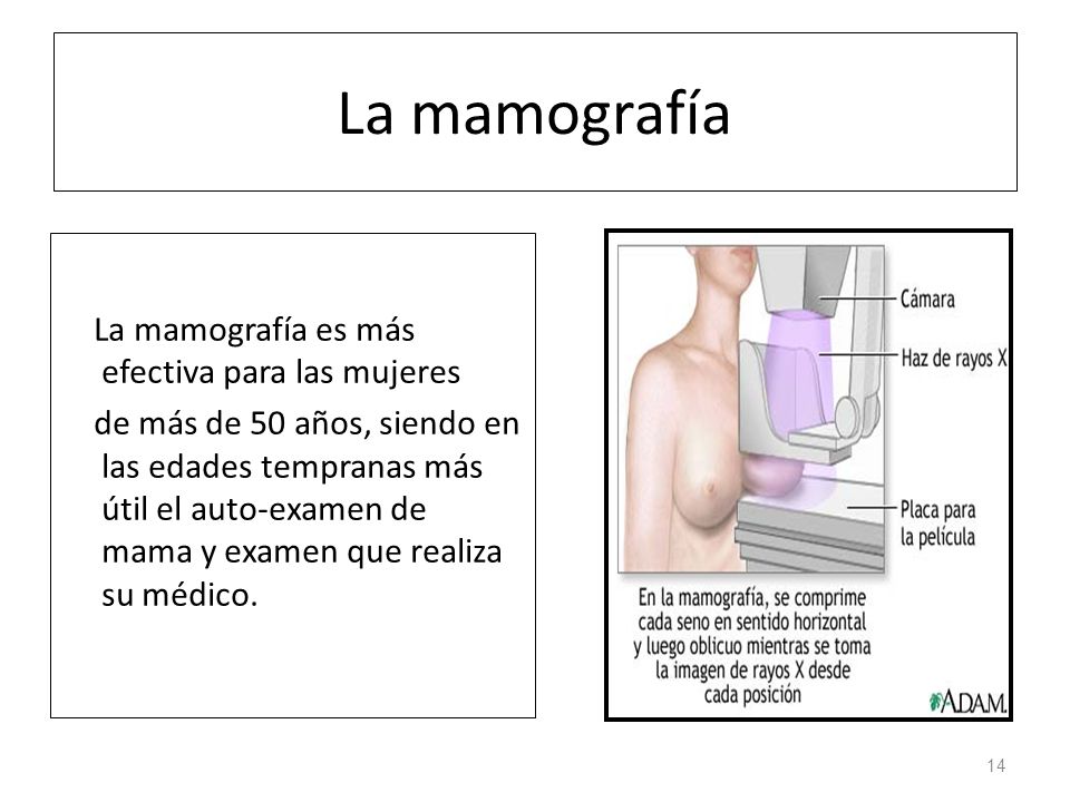 Como se hace el examen del seno